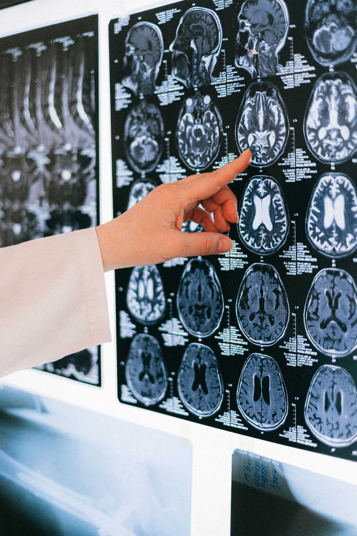 Clinician reviewing diagnostic imaging scans